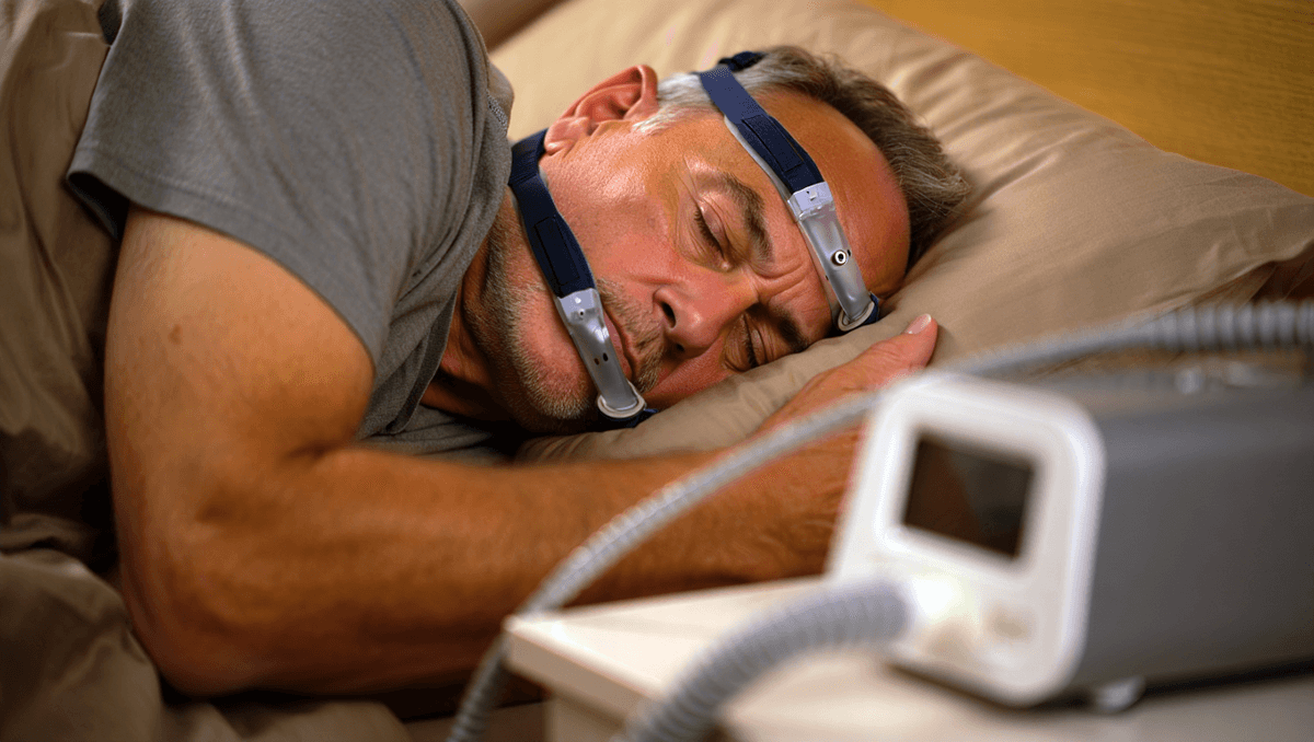 Мужчина спокойно спит с назальной маской в рамках CPAP-терапии для лечения апноэ сна