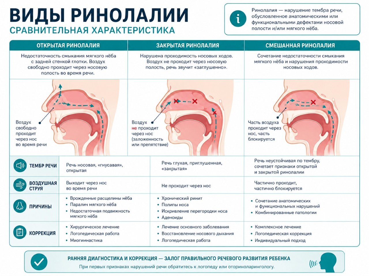 виды ринолалии открытая и закрытая гнусавость голоса инфографика